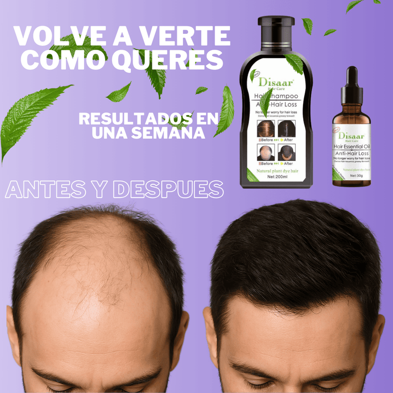 Combo Aceite + Shampoo Anticaida y Crecimiento Capilar
