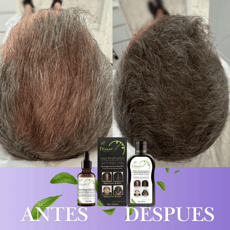 Combo Aceite + Shampoo Anticaida y Crecimiento Capilar